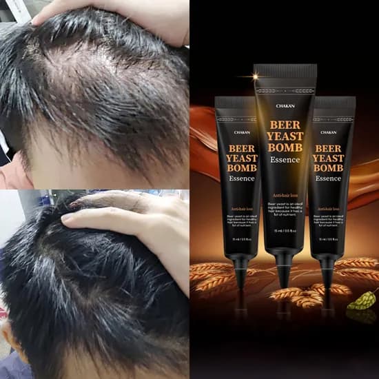 착한팩토리 맥주효모폭탄 두피에센스 15ml 3개