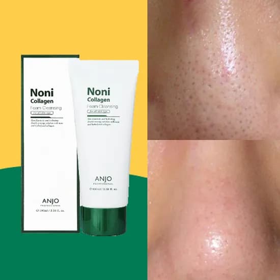 앙쥬 노니콜라겐 모공 폼클렌징 100ml 총 3개