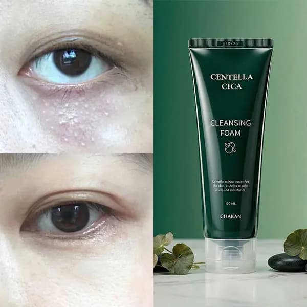 착한팩토리 센텔라시카 기미비립종 클렌징폼 120ml 1개
