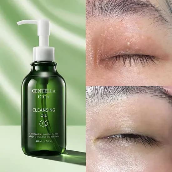 센텔라시카 기미비립종 클렌징오일, 200ml, 2개