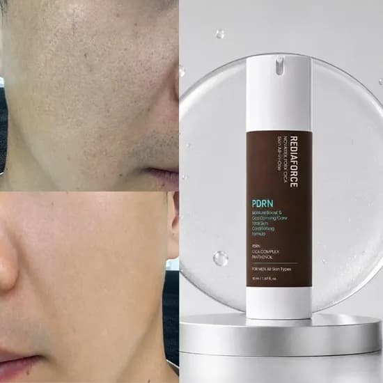 리다이아포스 PDRN 시카 올인원 로션, 150ml, 1개