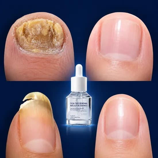 시카트리 네일에센스, 15ml, 2개입, 2병
