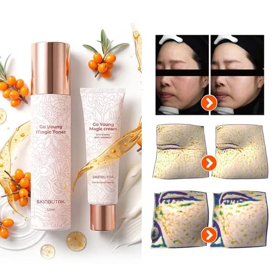 스킨부탁 고 영 매직 토너 120ml + 고 영 매직 크림 50ml