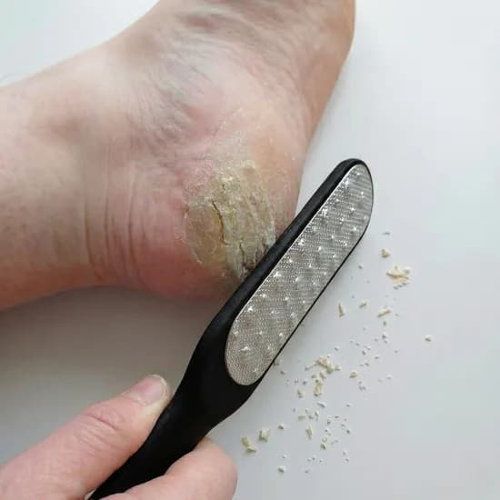 발 뒷꿈치 각질제거기, 35g, 2개
