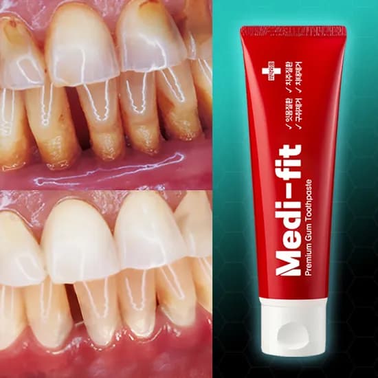 메디핏 잇몸치약, 120g, 1개