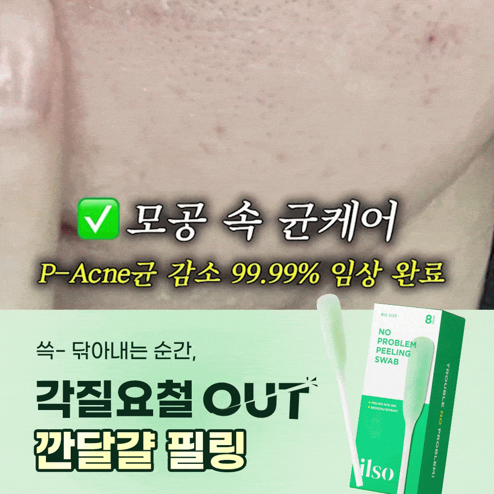 필링스왑